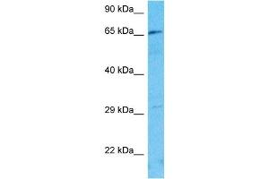 Host:  Rabbit  Target Name:  FBXL19  Sample Type:  Jurkat Whole Cell lysates  Antibody Dilution:  1. (FBXL19 anticorps  (Middle Region))
