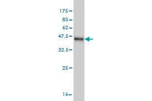 Western Blot detection against Immunogen (37.