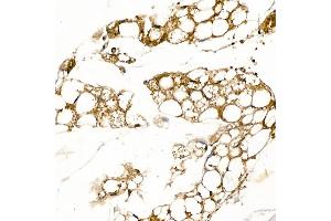 Immunohistochemistry of paraffin-embedded mouse brown adipose using UCP1 Rabbit pAb (ABIN6128899, ABIN6149883, ABIN6149885 and ABIN6221561) at dilution of 1:50 (40x lens).