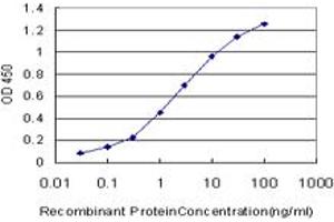 Detection limit for recombinant GST tagged MKI67 is approximately 0.