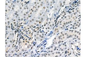 Phospho-JAK2 (Tyr1007/Tyr1008) Antibody at 1/100 staining Mouse kidney tissue by IHC-P. (JAK2 anticorps  (pTyr1007, pTyr1008))