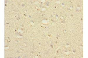 Immunohistochemistry of paraffin-embedded human brain tissue using ABIN7161462 at dilution of 1:100