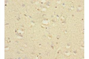 Immunohistochemistry of paraffin-embedded human brain tissue using ABIN7161462 at dilution of 1:100 (Neurotrimin anticorps  (AA 30-316))