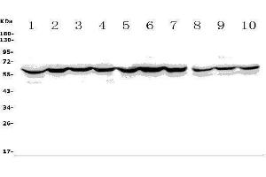 Western blot analysis of ASIC2 using anti-ASIC2 antibody (ABIN7601023).