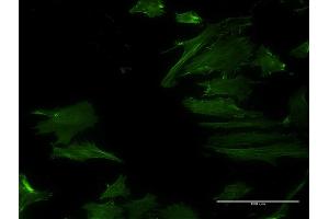 Immunofluorescence of monoclonal antibody to DPH2 on HeLa cell.