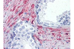 IHC Image for AP22885PU-N Prostate, Human: Formalin-Fixed, Paraffin-Embedded (FFPE) (PRKG1 anticorps)