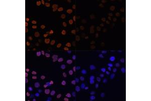 Immunofluorescence analysis of HeLa cells using Acetyl-Histone H2B-K12 antibody (ABIN7267731) at dilution of 1:100.