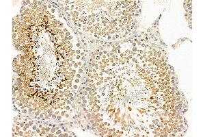 ABIN7094857 and ABIN7098908 at 1/100 staining Rat testis tissue by IHC-P.
