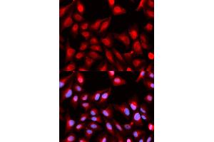 Immunofluorescence analysis of U2OS cells using DDX5 antibody (ABIN5973042). (DDX5 anticorps)