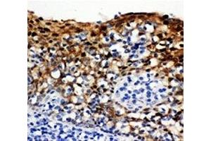 IHC-P: 14-3-3 sigma antibody testing of human tonsil tissue (14-3-3 sigma/SFN anticorps  (AA 140-156))