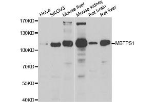 Western blot analysis of extracts of various cell lines, using MBTPS1 antibody (ABIN5974226) at 1/1000 dilution. (MBTPS1 anticorps)