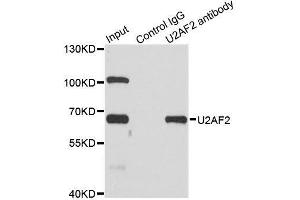 Immunoprecipitation analysis of 200ug extracts of SW620 cells using 1ug U2AF2 antibody.