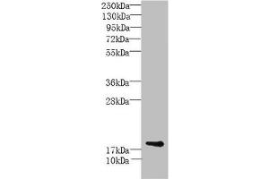 Western Blot All lanes: MORN5 antibody at 4 μg/mL + Mouse brain tissue Secondary Goat polyclonal to rabbit IgG at 1/10000 dilution Predicted band size: 19, 21 kDa Observed band size: 19 kDa (MORN5 anticorps  (AA 1-161))