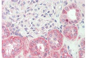 Rabbit Anti-KLHL25 antibody  Formalin Fixed Paraffin Embedded Tissue: Human Kidney Primary antibody Concentration: 1:100 Secondary Antibody: Donkey anti-Rabbit-Cy3 Secondary Antibody Concentration: 1:200 Magnification: 20x Exposure Time: 0. (KLHL25 anticorps  (N-Term))