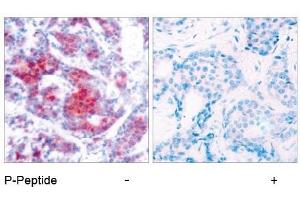 Image no. 1 for anti-Signal Transducer and Activator of Transcription 4 (STAT4) (pTyr693) antibody (ABIN196694) (STAT4 anticorps  (pTyr693))