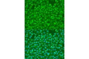 Immunofluorescence analysis of U2OS cells using SMAD7 antibody (ABIN2737563) at dilution of 1:100. (SMAD7 anticorps)