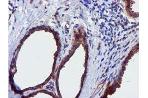 Immunohistochemical staining of paraffin-embedded Human breast tissue using anti-EPN2 mouse monoclonal antibody. (Epsin 2 anticorps)