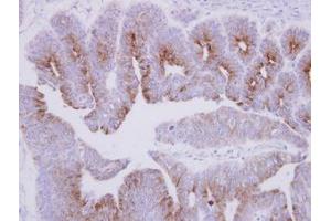 Image no. 1 for anti-Microtubule-Associated Protein 7 (MAP7) (C-Term) antibody (ABIN1491813) (MAP7 anticorps  (C-Term))