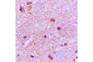 anti-Tumor Protein P53 Inducible Nuclear Protein 1 (TP53INP1) (C-Term) antibody