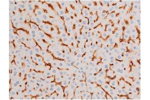 ABIN6267579 at 1/200 staining Mouse liver tissue sections by IHC-P.