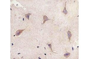 IHC analysis of FFPE human brain section using TSC2 antibody; Ab was diluted at 1:25. (Tuberin anticorps  (AA 1397-1426))