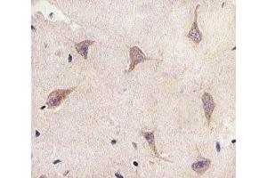 IHC analysis of FFPE human brain section using TSC2 antibody; Ab was diluted at 1:25.