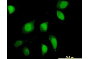 Immunofluorescence of monoclonal antibody to FOXO1 on HeLa cell.