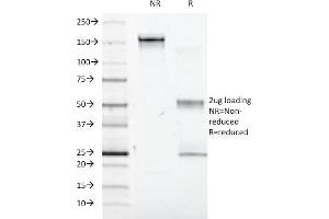 SDS-PAGE Analysis Purified Interferon alpha-1 Mouse Monoclonal Antibody (2-48). (IFNA1 anticorps)