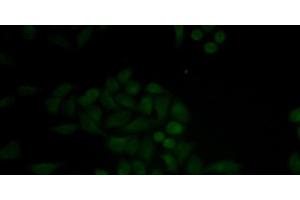 Immunofluorescence analysis of MCF-7 cells using CTSE Polyclonal Antibody (Cathepsin E anticorps)