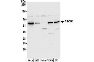 Western Blotting (WB) image for anti-Fascin (FSCN1) (AA 25-75) antibody (ABIN7449737)