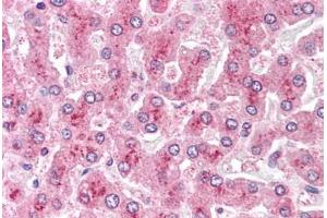 Human Liver: Formalin-Fixed, Paraffin-Embedded (FFPE)