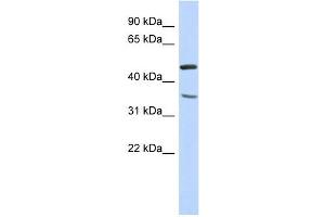 FAM81B antibody used at 1 ug/ml to detect target protein. (FAM81B anticorps  (N-Term))