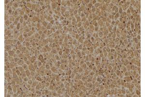 ABIN6274922 at 1/100 staining Mouse liver tissue by IHC-P.