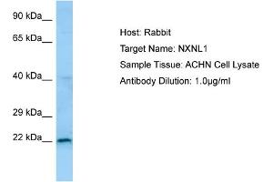 Western Blotting (WB) image for anti-Nucleoredoxin Like Protein 1 (NXNL1) (N-Term) antibody (ABIN2790127) (NXNL1 anticorps  (N-Term))
