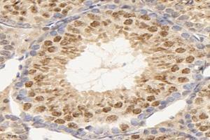 Immunohistochemistry analysis of paraffin-embedded mouse testis using,TEX11 (ABIN7075862) at dilution of 1: 2000