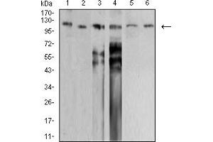 Western blot analysis using SMARCA1 mouse mAb against PANC-1 (1), HEK293 (2), SW620 (3), HT-29 (4), SH-SY5Y (5), and SK-OV-3 (6) cell lysate. (SMARCA1 anticorps  (AA 933-1070))
