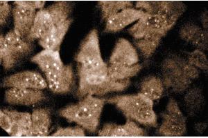 Immunofluorescence staining of HeLa cells (Human cervical epitheloid carcinoma, ATCC CCL-2. (SNRPN anticorps  (AA 14-174))