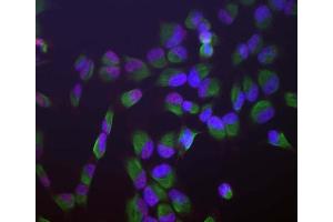 Human HeLa cells stained with ABIN1580459 (red), chicken antibody to vimentin CPCA-Vim (green) and DNA (blue, stained with DAPI).