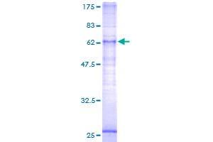 Image no. 1 for Lysophosphatidic Acid Receptor 5 (LPAR5) (AA 1-372) protein (GST tag) (ABIN1309689)