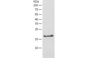 Western Blotting (WB) image for Programmed Cell Death 6 (PDCD6) (AA 1-191) protein (His-IF2DI Tag) (ABIN7124577)