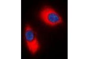 Immunofluorescent analysis of p47 phox staining in Jurkat cells. (NCF1 anticorps  (C-Term))