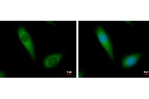 ICC/IF Image NDUFA10 antibody [N1C3] detects NDUFA10 protein at cytoplasm by immunofluorescent analysis. (NDUFA10 anticorps  (Center))