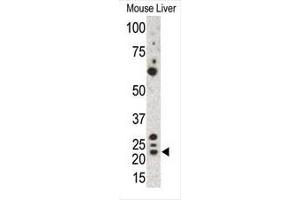 Western blot analysis of anti-Gremlin Pab in mouse liver cell lysate.