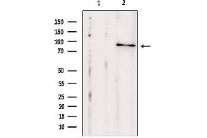 Western blot analysis of extracts from HepG2, using SEC5/EXOC2 antibody. (EXOC2 anticorps  (N-Term))