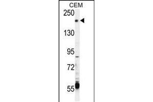 Western blot analysis in CEM cell line lysates (35ug/lane). (TRPM6 anticorps  (AA 317-348))