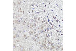 Immunohistochemistry of paraffin-embedded mouse brain using UBL3 antibody (ABIN6131930, ABIN6149849, ABIN6149850 and ABIN6220468) at dilution of 1:100 (40x lens).