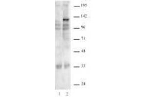 SaCas9 antibody (rAb) tested by Western blot.