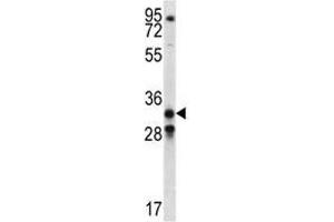 GDF15 antibody western blot analysis in NCI-H460 lysate (GDF15 anticorps  (AA 51-79))
