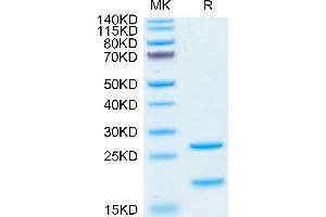 Human MASP2 on Tris-Bis PAGE under reduced condition.