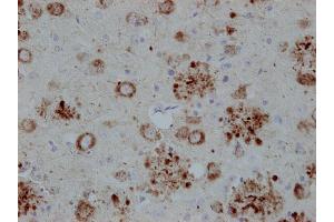 Immunostaining of paraffin embedded brain section from transgenic mouse expressing human APP (dilution 1 : 2000). (APP anticorps  (C-Term))